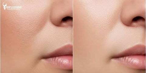 Women’s Pore Treatment: A Guide to Clearer-Looking Skin